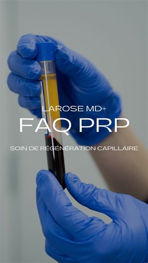 Le PRP, c’est la solution idéale pour redonner densité et vitalité à vos cheveux Si vous remarquez un éclaircissement, mais que vous avez encore une bonne base capillaire, vous êtes probablement un excellent candidat pour ce traitement naturel de régénération. Offre de lancement à partir du 19 novembre: 💥 À l’achat de 3 séances (600 $ chacune), la 4ᵉ est offerte! ✨ Valeur de 800$ par traitement Renforcez et préservez vos cheveux avec notre nouveau traitement dès le 19 novembre Saint-Jean-sur-Ri
