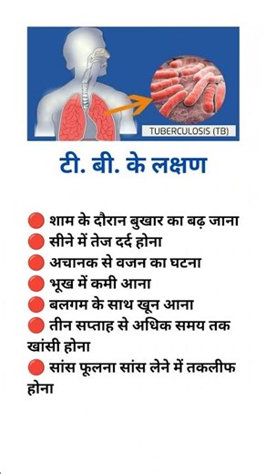 Early Signs & Symptoms of Tuberculosis (TB) You Should Never Ignore#TBsymptoms