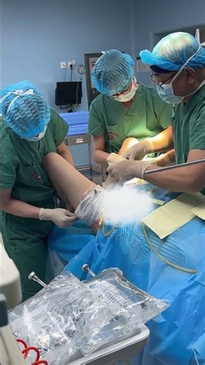 What are these doctors doing to the patient? #doctor #hospital