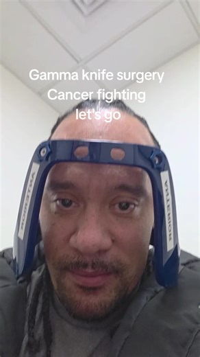 Gamma Knife Surgery: Fighting Cancer at UCLH Hospital