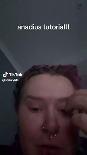 Anadius Tutorial: Overcoming Technical Issues