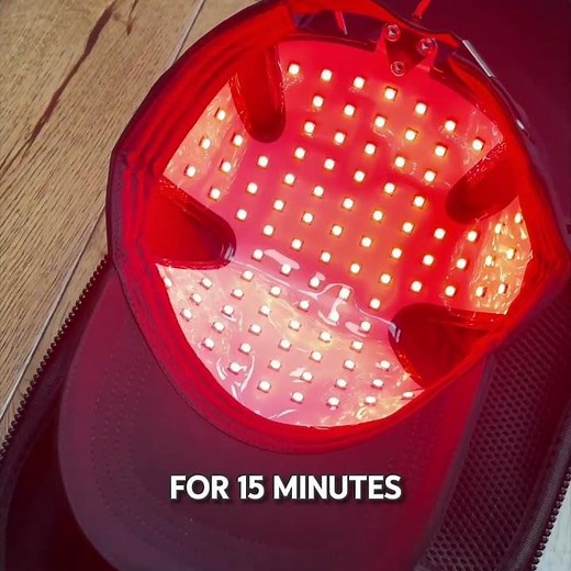 90 Day Hair Growth Results Using Red Light Therapy