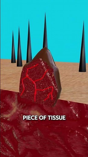 How to Safely Remove Skin Tags