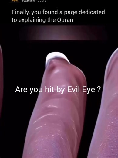 In Islam, the evil eye (al-‘ayn) is real and acknowledged in both the Qur’an and authentic hadith. The Prophet Muhammad ﷺ said, “The evil eye is real” (Muslim). It occurs when someone looks with envy or admiration without seeking Allah’s blessing, and it can cause harm only by Allah’s permission. Healing from the evil eye is done through ruqyah (Qur’anic healing): regularly reciting Surah Al-Fātiḥah, Ayat al-Kursi (2:255), Surah Al-Ikhlāṣ, Al-Falaq, and An-Nās, making sincere du‘ā’, remembering 