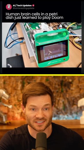 How Many Brain Cells Do You Need?