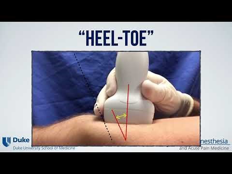 Ultrasound probe maneuvers to improve needle and target visualization