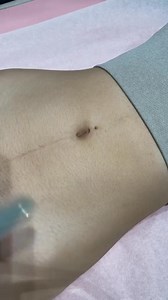 70K views · 190 reactions | အသား နုတဲ့နေရာလေးတွေကို self wax လုပ်ရင်...