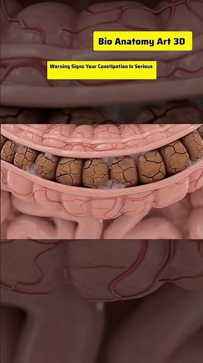 Warning Signs Your Constipation Is Serious | Bio Anatomy Art| Gut Health