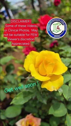 Pulled elbow | Supersupination method of Pulled elbow reduction | Adamya Hospital Videos