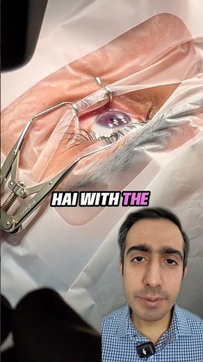 Streamlight laser explained #laser