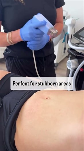 Morpheus8: Minimal Downtime, Maximum Results