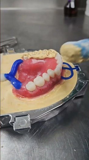 Ivoclar IvoBase Heat Injection with JTLabQueen #dentist #dental #teeth #dentures #denture