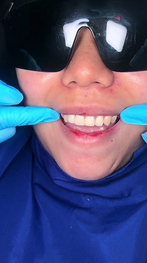 Maryland Bridge Dental Clinic in Cagayan De Oro City