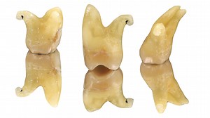 Molars anatomy pt1: upper second molar - Style Italiano Endodontics
