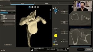 Blueprint 4.2.1 planning software walk-through with Dr. Ben Service