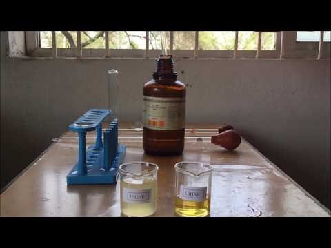 Albumin Detection in Urine | Sulfosalicylic Acid & Nitric Acid Test for Urine Analysis | ENGLISH