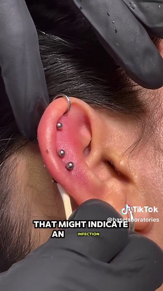 Helix Piercing Care: Managing Swelling and Irritation