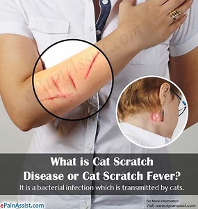 Cat-Scratch Fever 란 무엇인가? 그 원인은 무엇입니까? - 피부 문제 앤 치료 2026