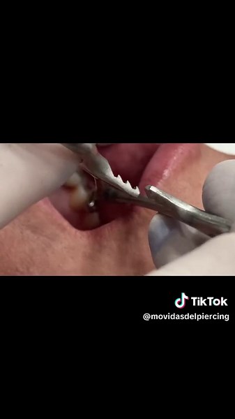 Problemas con el piercing de mejilla