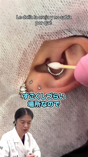[Pyogenic Granuloma] Never leave it untreated! Granulomas caused by cartilage piercings require i...