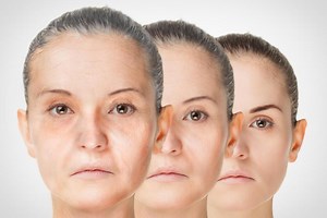 “Time Jump” by 30 Years: Old Skins Cells Reprogrammed To Regain Youthful Function – Lifeboat News: The Blog