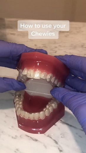 How to use your Chewies during your Invisalign treatment #fyp #orthodontics #invisalign #clonmel #tipperary #orthodonticsbyjackie #teeth #chewies