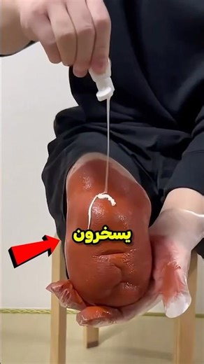 سخر منه المتنمرون... حتى رأوا ساقه 🎨❤️