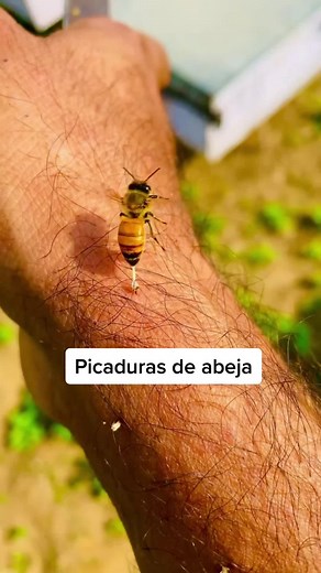Qué hacer si te pica una abeja: consejos y remedios efectivos