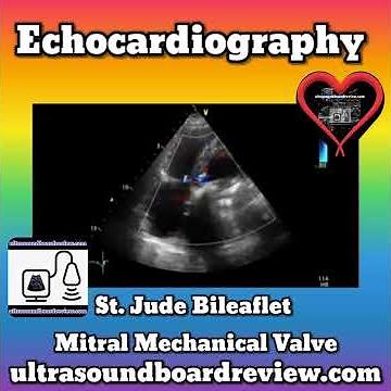 St. Jude Bileaflet Mechanical Mitral Valve, Echocardiography, Ultrasound Board Review, Exam Review