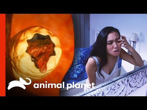 Literally Crawling in Her Skin? Rare Parasite Runs Rampant Inside Woman | Monsters Inside Me