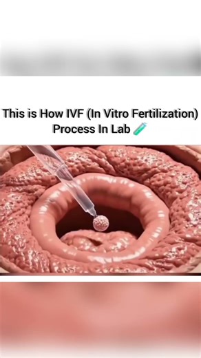 How IVF In Vitro Fertilization Process in lab | Test Tube 🧪 baby 👶 #ivf #biology #ivfmedication