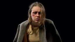 Desperate wounded woman touching cheek and crying, marital abuse,...