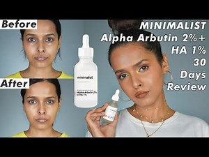 I Tried MINIMALIST's Alpha Arbutin 2% + HA 1% Serum for 30 Days & here's the review