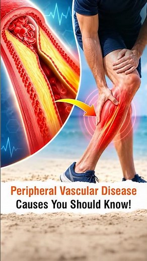 Peripheral Vascular Disease: Causes You Should Know! - Dr Devender Singh