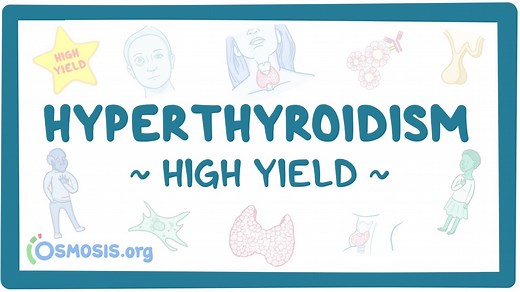 Hyperthyroidism: Pathology review: Video, Causes, & Meaning | Osmosis