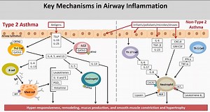 Asthma : Pathophysiology #asthma #pulmonology #physiology #pathology #respiratorymedicine #respiratorytherapist #medicalstudent #nurse #nursingstudent #USMLE #MRCP #FCPS #mrcpi #biochemistry #immunology #science #biology #NCLEX | Medicine E-Library