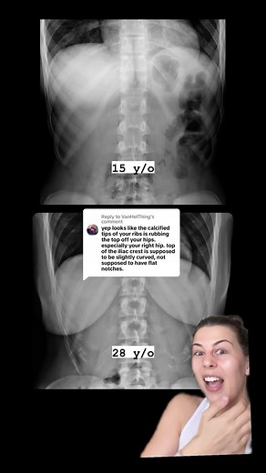 Understanding Bone Abnormalities Through X-Rays