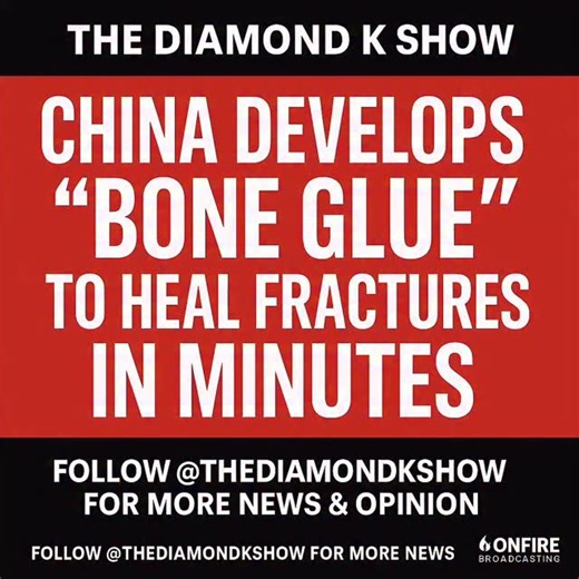 Scientists in China have unveiled a breakthrough “bone glue” that can heal fractures in just minutes! Inspired by oysters, this new medical adhesive bonds bones together in wet conditions and dissolves naturally over time — no second surgery needed. Could this change the future of medicine? 🦴⚡️ 🎙 The Diamond K Show Weekdays 6 PM | OnFireBroadcasting.com Follow 👉 @TheDiamondKShow @onfirebroadcasting | Dwayne Diamond K Williams