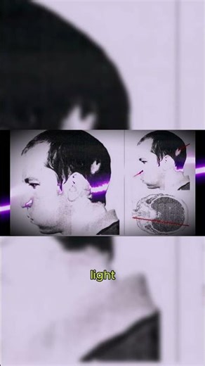 He put his HEAD inside a Particle Accelerator ⚡️#shorts #science #history #medicine