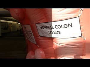 Giant inflatable colon stolen, prompting reward for its return