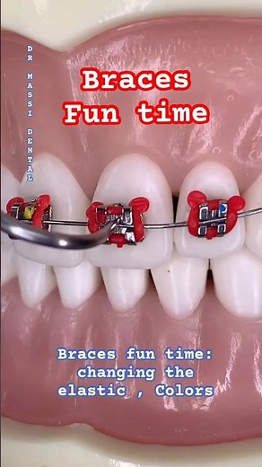 ORTHODONTICS •Braces | Elastic Color Change