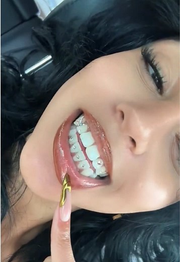 Tooth Gem Application Guide for Beginners
