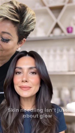 Skin needling, also known as collagen induction therapy, works by creating controlled micro-channels in the skin to stimulate natural collagen and elastin production. This treatment helps improve skin texture, firmness, acne scarring, fine lines and enlarged pores over time. Performed with professional medical-grade devices and customised depths for your skin condition. This is progressive skin repair — not a facial and not an instant fix. No hype. No guarantees. High trust. | Laila's Beauty & L