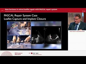 PASCAL repair system - New Horizons in mitral leaflet repair | Edwards Lifesciences symposium at ESC