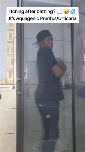 Do you itch after bathing?🔥 It's called Aquagenic Pruritus or Aquagenic Urticaria 🛁 Disclaimer: ​"All posts and opinions are strictly my own and do not reflect the views of my employer or any affiliated health establishment. Content is for general educational purposes only and is not a substitute for professional medical advice, diagnosis, or treatment. Please consult your personal healthcare provider for specific medical concerns." #kamotjelele #health #aquagenicurticaria #aquagenicpruritus #