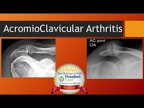 Acromioclavicular Arthritis