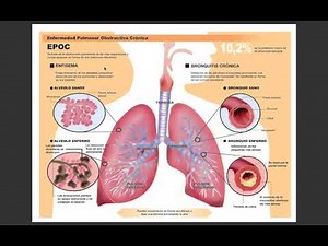 Lung diseases
