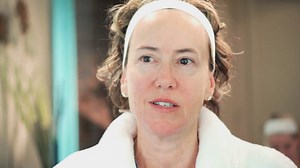 Derm Exclusive Infomercial