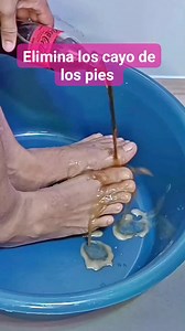 Con este truco puedes eliminar esa piel muerta de tus pies. #viralreels #facebookreels #reels #salud #pies | hogar y cocina