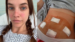 'Sleepless Nights On Bathroom Floor': Barbara Palvin On Undergoing Endometriosis Surgery